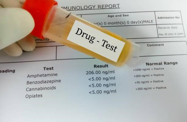 Drug test report